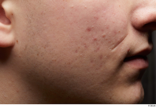  HD Face Skin Casey Schneider cheek face lips mouth scar skin pores skin texture 0001.jpg